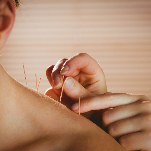 Acupuncture-momentum-health-calgary-ab