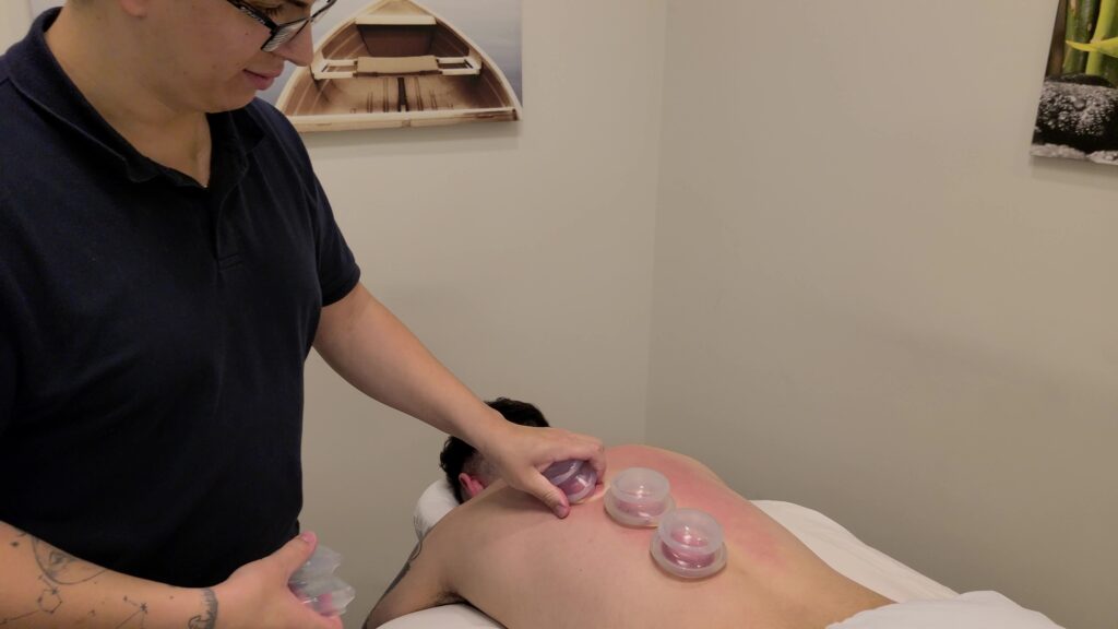Cupping Massage in Seton