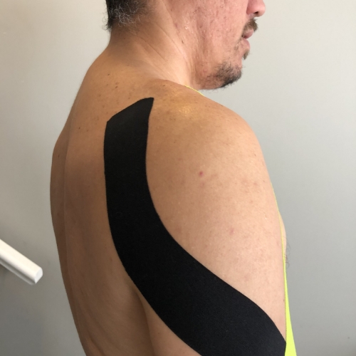 Kinesio-taping-momentum-health-calgary-ab