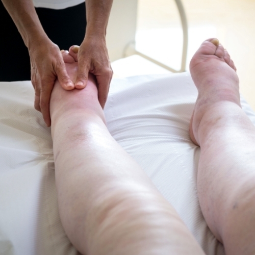 Lymphedema-momentum-health-calgary-ab