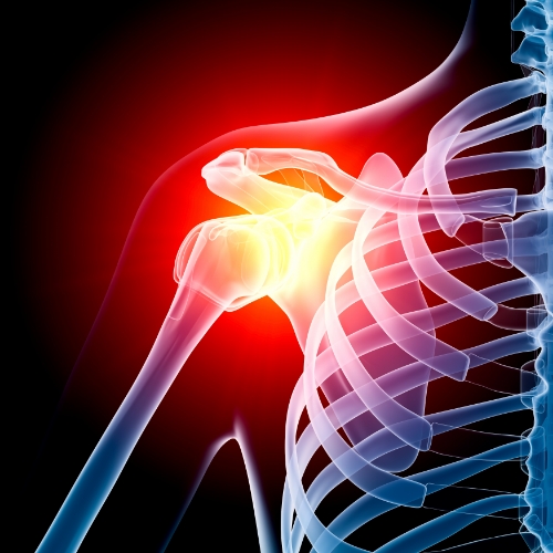 Shoulder-pain-momentum-health-calgary-ab