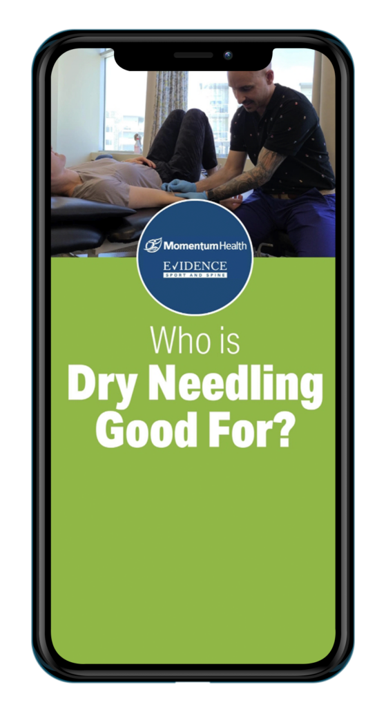 Who is Dry Needling Good For?