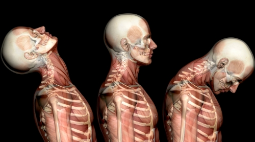 Momentum-health-calgary-motor-vehicle-accident-injuries