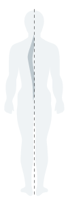 Scoliosis-Body-Icon